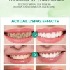 Before and after results using alcohol-free probiotic mouthwash: reduced plaque, healthier gums and brighter teeth Before and after results using alcohol-free probiotic mouthwash: reduced plaque, healthier gums and brighter teeth