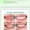 Before and after results using teeth whitening toothpaste – natural stain removal for brighter teeth (individual results may vary) Before and after results using teeth whitening toothpaste – natural stain removal for brighter teeth (individual results may vary)
